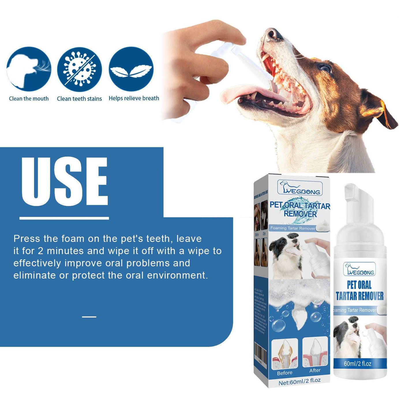 Dental Foam Cleaner For Removing Calculus, Yellow Teeth, Bad Breath, Teeth Cleaning