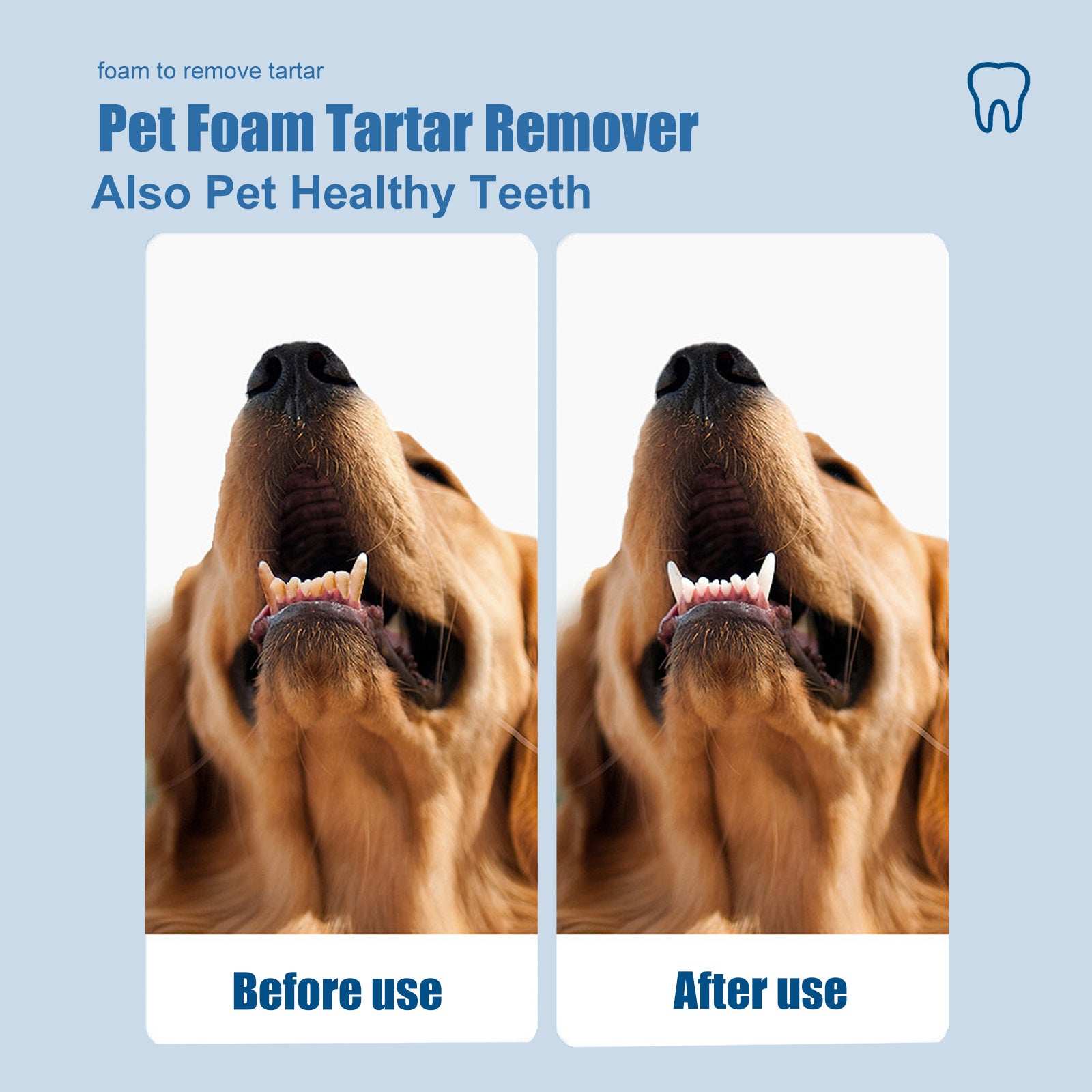 Dental Foam Cleaner For Removing Calculus, Yellow Teeth, Bad Breath, Teeth Cleaning